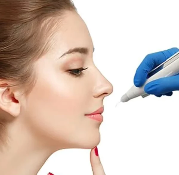 PLASMA LIFT FIBROBLAST